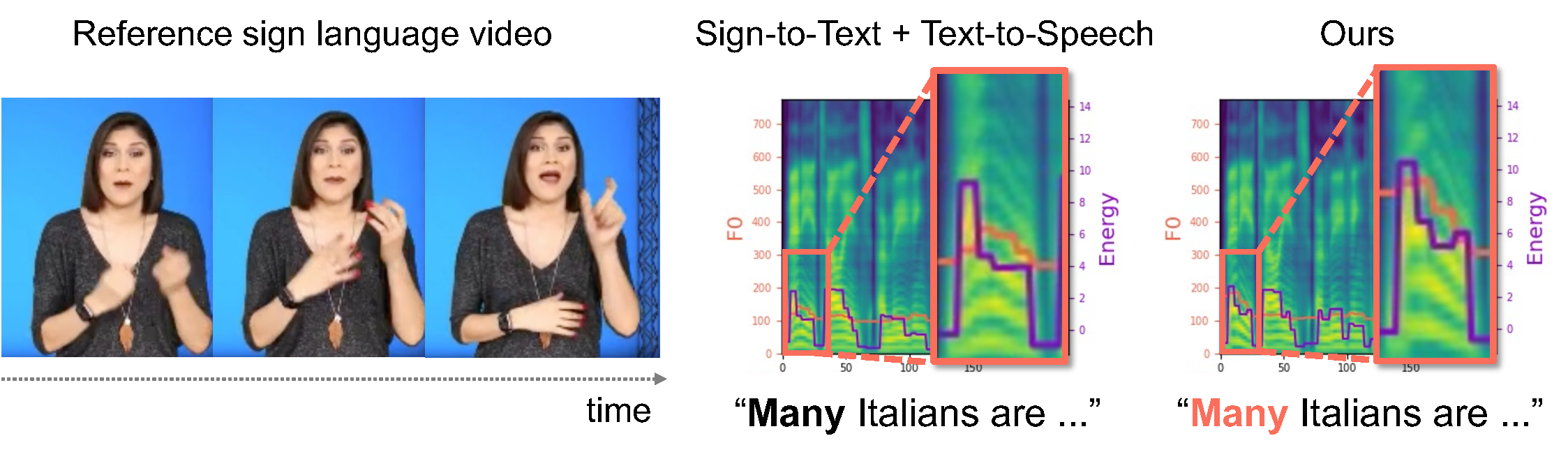 Teaser: Sign-to-Speech Prosody Transfer comparison